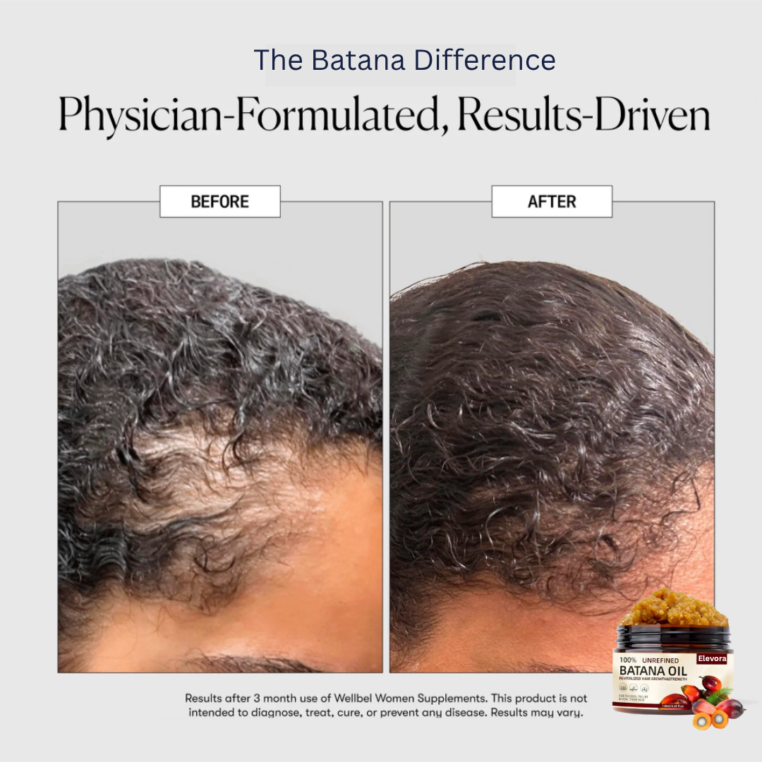 Elevora™ - Natural Batana Hair Growth Oil