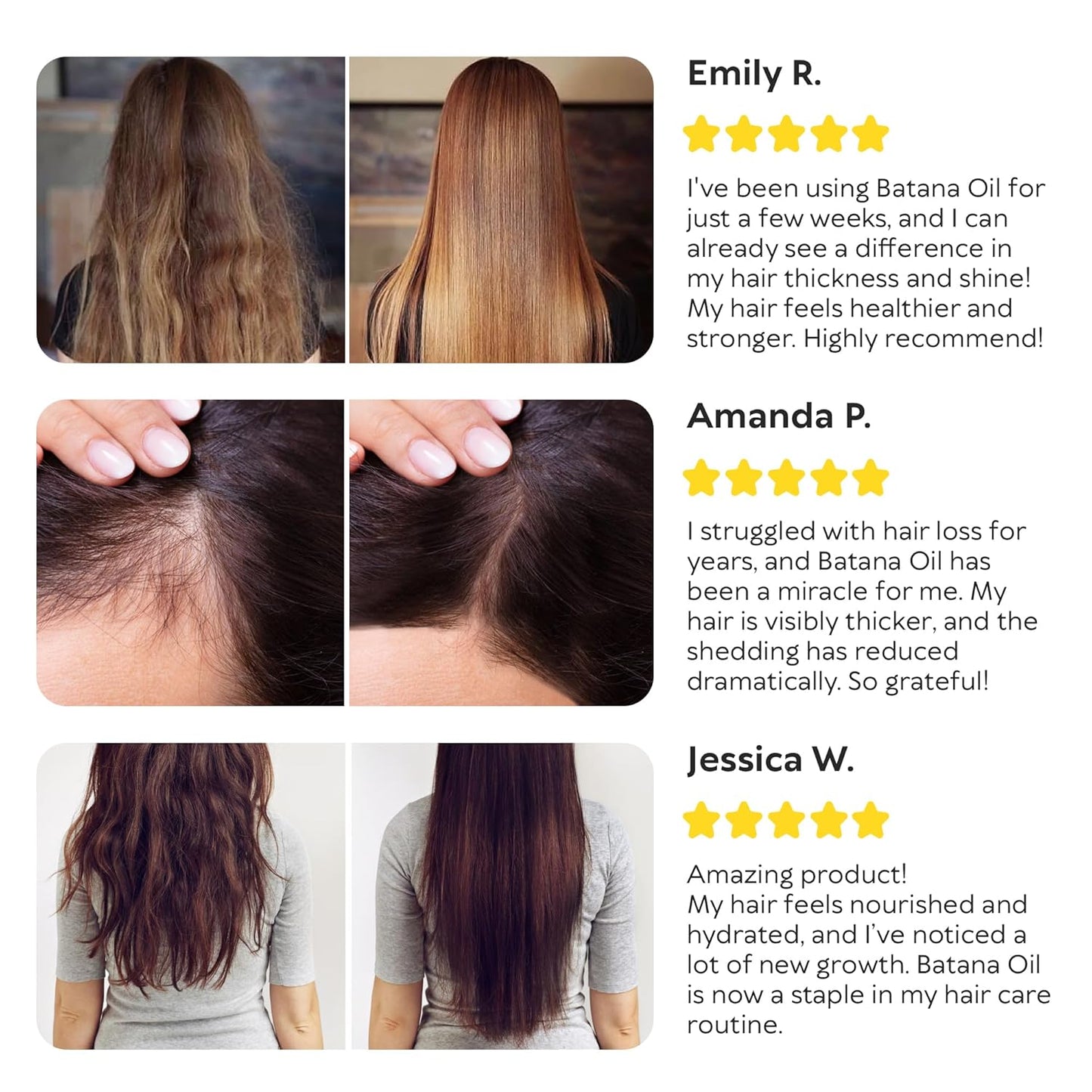 Elevora™ - Natural Batana Hair Growth Oil