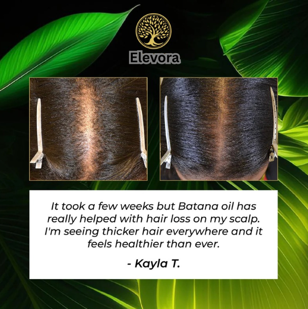 Elevora™ - Natural Batana Oil Travel Serum