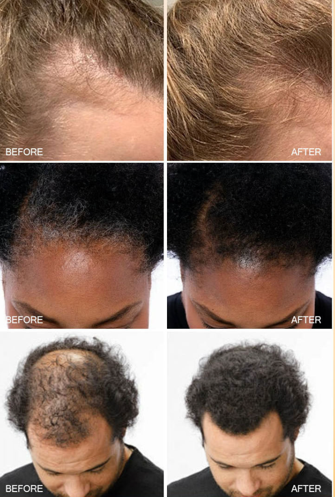 Elevora™ - Natural Batana Oil Conditioner