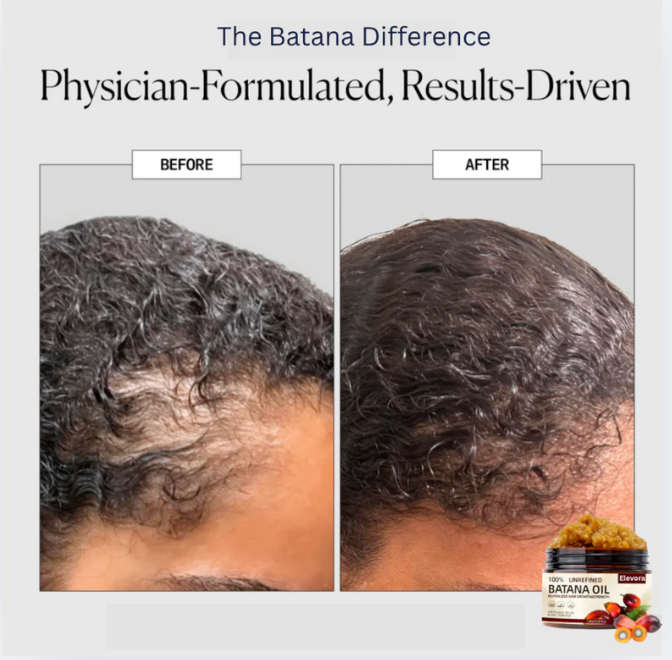 Elevora™ - Natural Batana Hair Growth Oil