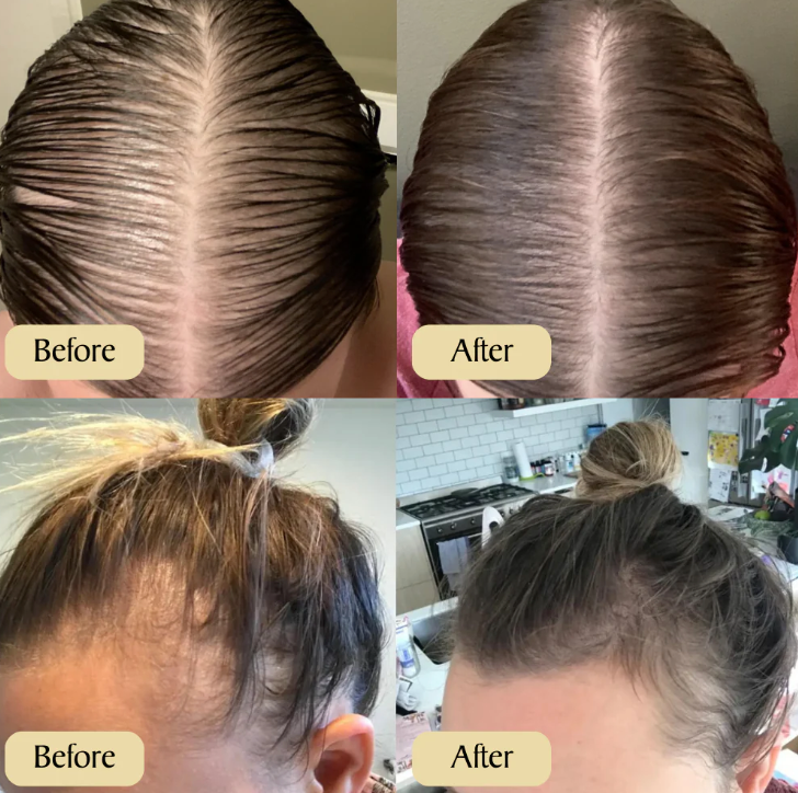 Elevora™ - Natural Batana Oil Shampoo