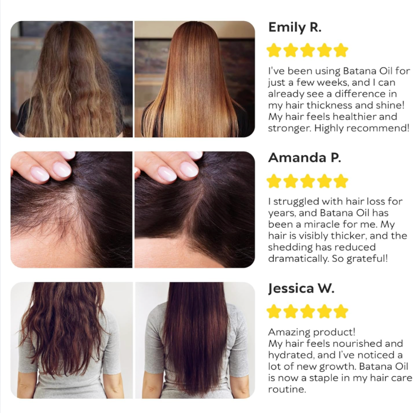 Elevora - Natural Batana Hair Oil