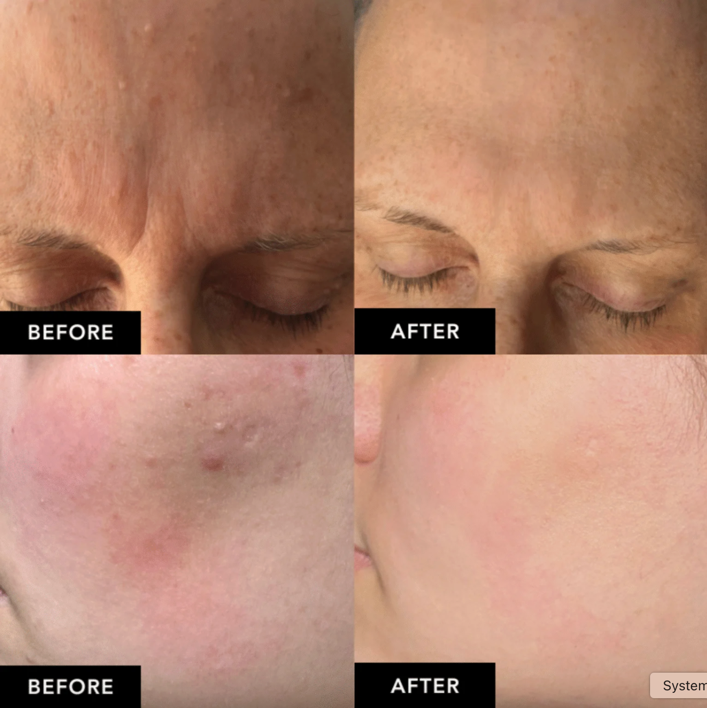 Elevora™ Red Light Skin Glow-Up Wand