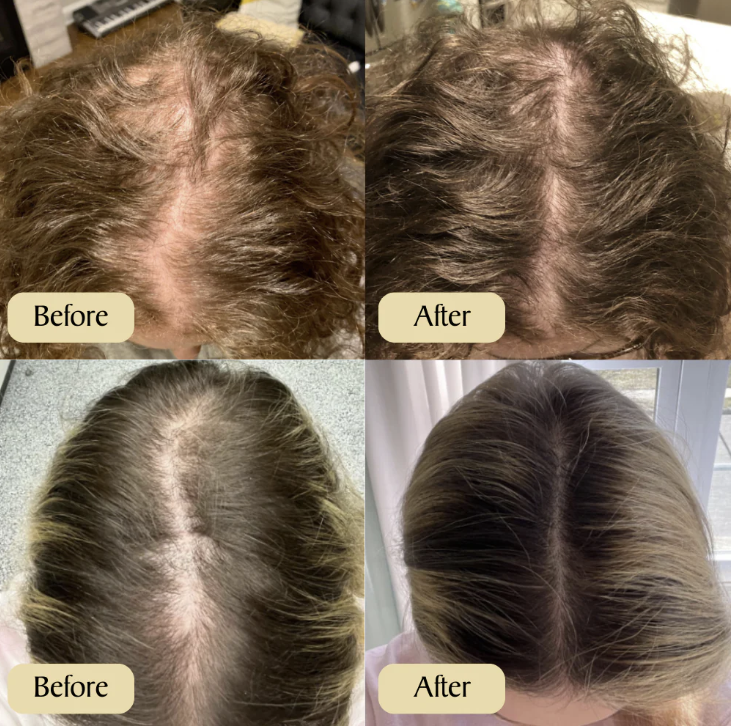 Elevora™  - Natural Batana Hair Growth Oil