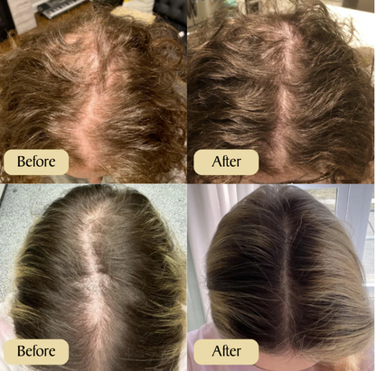 Elevora™  - Natural Batana Hair Growth Oil