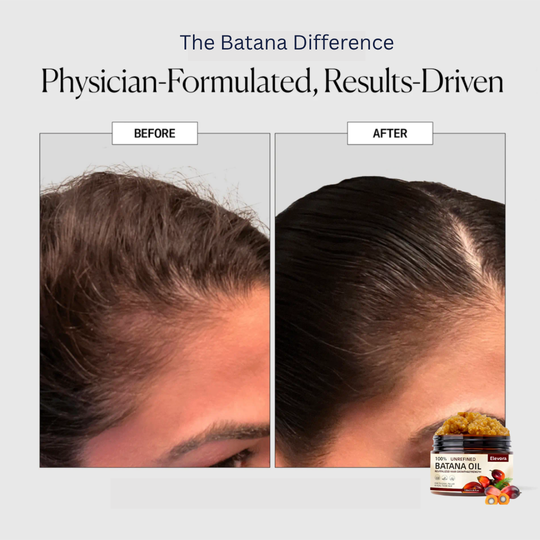 Elevora - Natural Batana Hair Oil