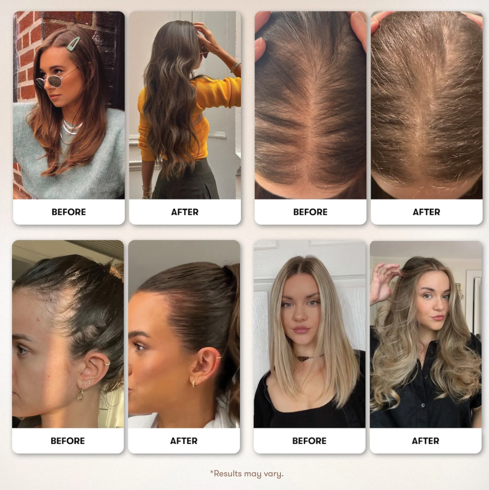 Elevora - Natural Batana Hair Oil